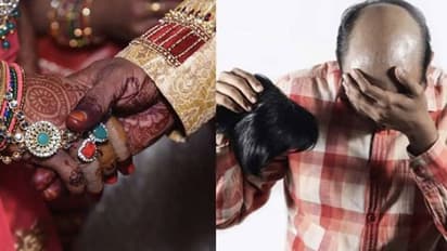 ವಿಗ್ ಹಾಕ್ಕೊಂಡು ಎರಡನೇ ಮದ್ವೆಯಾಗಲು ಬಂದಿದ್ದ ವರ, ಬೋಳು ತಲೆ ನೋಡಿ ತಲೆಸುತ್ತಿ ಬಿದ್ದ ವಧು!