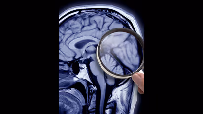 ഇത് ചരിത്രം; അല്ഷിമേഴ്സ് രോഗത്തിനുള്ള മരുന്ന് വരുന്നു...