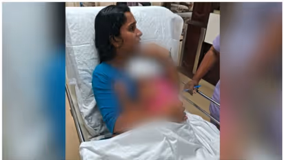  മൂന്നു വയസ്സുകാരിയെ തെരുവുനായ് ആക്രമിച്ചു; കുഞ്ഞിന്റെ മുഖത്ത് ​ഗുരുതര പരിക്ക്
