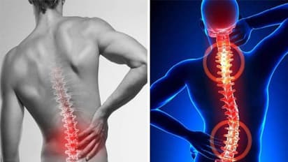 Health Tips: ಬೆನ್ನುನೋವಾ? ನಿಮ್ಮ ಥೋರಾಸಿಕ್ ಬೆನ್ನುಮೂಳೆ ಹಾನಿಗೆ ಒಳಗಾಗಿರ್ಬೋದು ಎಚ್ಚರ
