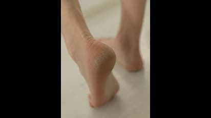 காலை எழுந்ததும் குதிகால் வலிக்குதா? நொடியில் நிவாரணம் கிடைக்க சூப்பர் டிப்ஸ்!!