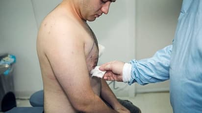 പുരുഷന്മാരിലെ സ്തനവളര്ച്ചയ്ക്ക് എന്താണ് പരിഹാരം?; 21-40 വരെ പ്രായമുള്ളവര് അറിയാൻ...