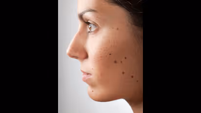 ఇక్కడ పుట్టుమచ్చలుంటే మీరు అదృష్టవంతులే..!