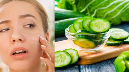 വരണ്ട ചര്മ്മമുള്ളവര് കഴിക്കേണ്ട ആറ് ഭക്ഷണങ്ങള്...