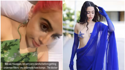 Uorfi Javed opens up about her plastic surgery, warns followers to be careful