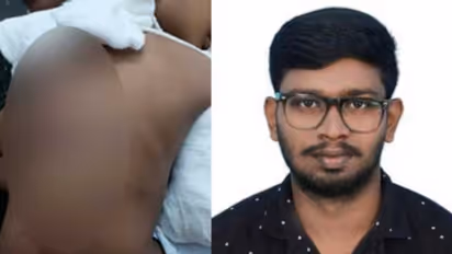 വീടിന് കാവലായി 4 നായകള്, മദ്യപിച്ചെത്തി 5 വയസുകാരന്റെ കൈ തല്ലിയൊടിച്ചു; രണ്ടാനച്ഛന് പിടിയില്