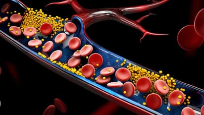 ചീത്ത കൊളസ്ട്രോൾ കുറയ്ക്കാൻ ഇവ കഴിക്കാം