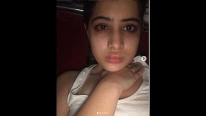 ಚಿತ್ರ ವಿಚಿತ್ರ ಫ್ಯಾಷನ್‌ನಿಂದ ಫೇಮಸ್ ಆಗಿರೋ ಉರ್ಫಿ ಜಾವೇದ್ ಮೇಕಪ್ ಇಲ್ಲದೇ ಕಾಣಿಸೋದು ಹೀಗೆ!