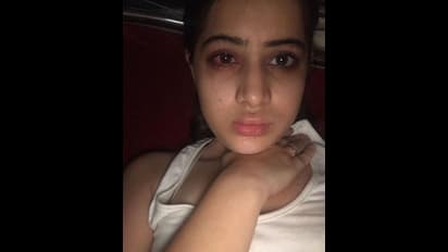 గుర్తుపట్టలేకుండా మారిపోయిన ఉర్ఫీ జావెద్.. కారణం ఇదే? పిక్స్ వైరల్ 