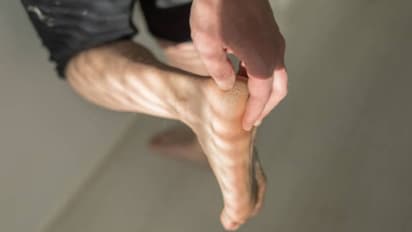 എന്തുകൊണ്ട് കാലില് ചൊറിച്ചിലും പുണ്ണും വരുന്നു? ചികിത്സ വൈകിച്ചാല് പ്രശ്നം...