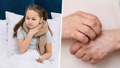 Monsoon Care: 5 types of deadly Fevers that can weaken your Body Immunity