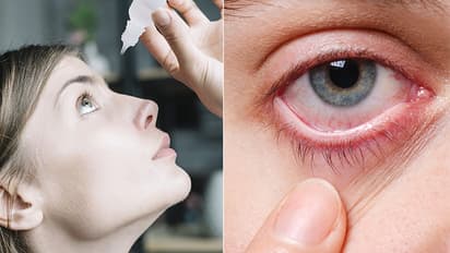 Conjunctivitis: இந்த எச்சரிக்கை அறிகுறிகளை கவனிக்காம இருந்தா மிகப்பெரிய சிக்கல்.. 