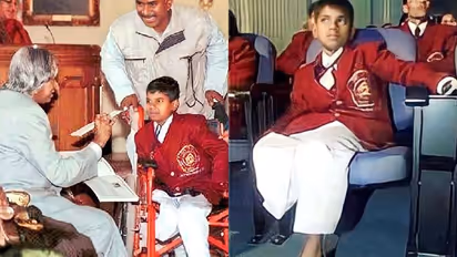 Riyaz lost his hands and a leg while saving the life of a girl, and received gallantry awards