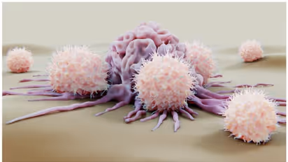 അമിതവണ്ണം ഈ കാൻസറിനുള്ള സാധ്യത വർദ്ധിപ്പിക്കുന്നു ; ആരോ​ഗ്യകരമായ ജീവിതശെെലി പിന്തുടരണമെന്ന്  ആരോ​ഗ്യവിദ​ഗ്ധർ