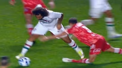 ఫుట్‌బాల్‌ గ్రౌండ్‌లో దురదృష్టకర ఘటన : బాల్‌ను ఓవర్‌షాట్ చేస్తూ ప్రత్యర్ధి కాలును విరిచేశాడు.. వీడియో వైరల్