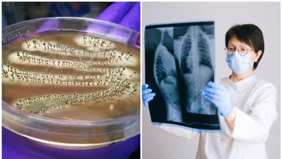 Penicillin to X-rays: 7 groundbreaking discoveries in Medical Science that revolutionized healthcare