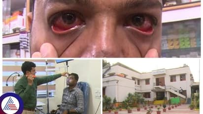 ವಿಜಯಪುರದ ಕೋಚಿಂಗ್ ಸೆಂಟರ್ಗಳಲ್ಲಿ ಮದ್ರಾಸ್ ಐ ಹಾವಳಿ: ಹಾಸ್ಟೆಲ್ ಹುಡುಗರ ಪರದಾಟ