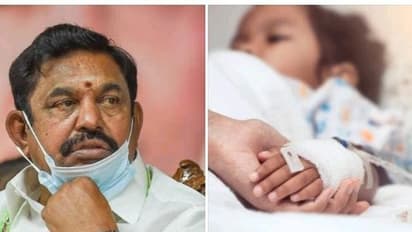 Amoeba : மூளையை உண்ணும் அமீபா.!! 3 சிறுவர்கள் அடுத்தடுத்து பலி.. தமிழக அரசை அலர்ட் செய்யும் எடப்பாடி பழனிசாமி