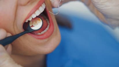 പല്ലില് പോട് വരാനും പല്ല് നശിക്കാനും കാരണമാകുന്ന അഞ്ച് ശീലങ്ങള്...