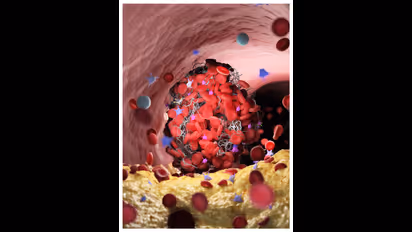  കൊളസ്ട്രോൾ നിയന്ത്രിക്കാൻ ജീവിതശെെലിയിൽ വരുത്തേണ്ട ഏഴ് മാറ്റങ്ങൾ 