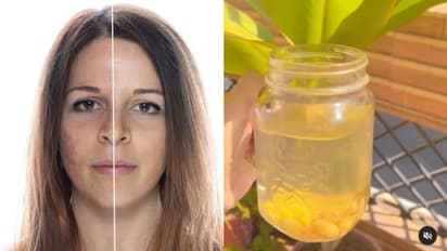  മുഖക്കുരുവിനെ തടയാന്‍ കുതിർത്ത ഉണക്കമുന്തിരി വെള്ളം ഇങ്ങനെ കുടിക്കാം... 