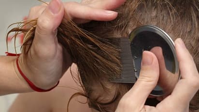 മകളുടെ തലയിലെ പേനിനെ കൊല്ലാറില്ല; കാരണം വെളിപ്പെടുത്തിയ അമ്മയ്ക്ക് ട്രോള്‍...