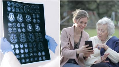 Effective strategies to prevent Alzheimer's risk and promote Brain Health