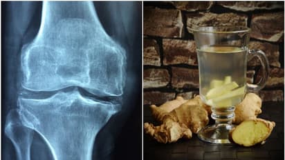 Discover 7 Natural Remedies for Joint Pain: Alleviate discomfort and enhance mobility