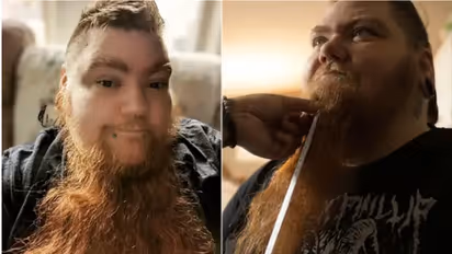 WATCH: US woman with PCOS shatters Guinness World Record for longest female beard