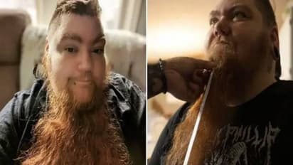 പുരുഷന്മാര്ക്ക് പോലും അസൂയ, ലോകത്തിലെ ഏറ്റവും വലിയ താടിക്കാരി ഇവർ, നീളം 11.81 ഇഞ്ച്!