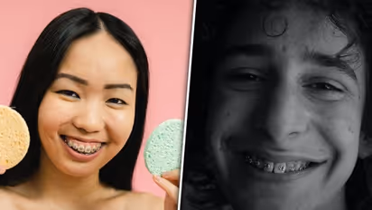 Age to professional advice: 6 factors to keep in mind before getting teeth braces