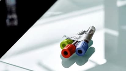  ശ്വാസകോശാര്‍ബുദ സാധ്യത നേരത്തെ പ്രവചിക്കാന്‍ കഴിയുന്ന രക്തപരിശോധന വികസിപ്പിച്ച് ഗവേഷകര്‍ 