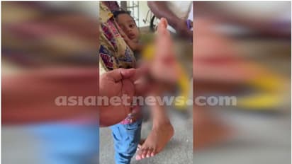 ഗുരുവായൂരിൽ ക്ഷേത്ര ദർശനത്തിനെത്തിയ 4 വയസ്സുകാരനെ തെരുവുനായകൾ ആക്രമിച്ചു 