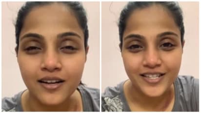 விபத்தில் சிக்கிய விஜய் டிவி சீரியல் நடிகை..! சீட் பெல்ட் போட்டதால் தப்பித்தேன்! காயங்களுடன் வெளியிட்ட வீடியோ!