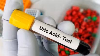 Health Tips: ശരീരത്തില് യൂറിക് ആസിഡ് കൂടിയാല് എന്തുസംഭവിക്കും? ഭക്ഷണത്തില് ശ്രദ്ധിക്കേണ്ട കാര്യങ്ങള്...