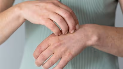 സോറിയാസിസ് രോഗത്തെ എങ്ങനെ തിരിച്ചറിയും? ലക്ഷണങ്ങള്‍ ഇങ്ങനെ... 