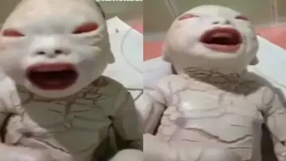 Viral Video: दुनिया में जन्मा 'एलियन', डॉक्टर के उड़े होश 