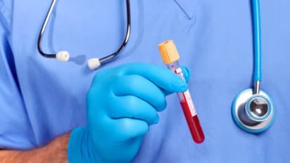 ഹീമോഗ്ലോബിൻ എളുപ്പത്തില്‍ കൂട്ടാം; ഈ ഭക്ഷണങ്ങള്‍ കഴിച്ചാല്‍ മതി...