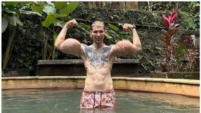 സുന്ദരികളെ ആകര്‍ഷിക്കാന്‍ കൈയില്‍ പെട്രോളിയം ജെല്ലി കുത്തിവച്ചു; പിന്നാലെ കിട്ടിയത് ‘റഷ്യൻ പോപ്പേ’ എന്ന പേര് !