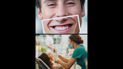 ಹಲ್ಲಿನ ಬಗ್ಗೆ ನಿಮಗೂ ಭಯ ಇದ್ಯಾ? ಕಾಡ್ತಿರಬಹುದು ಡೆಂಟಲ್ ಎಂಕ್ಸೈಟಿ