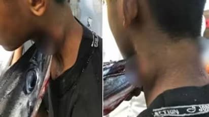 മീൻപിടിക്കാൻ പോയ യുവാവിന്റെ കഴുത്തിൽ തുളച്ചുകയറി മീൻ, നീക്കം ചെയ്യാൻ ഒരു മണിക്കൂർ നീണ്ട ശസ്ത്രക്രിയ