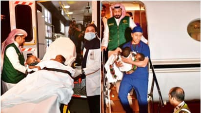 വേർപെടുത്തൽ ശസ്ത്രക്രിയക്കായി താൻസാനിയൻ സയാമീസ് ഇരട്ടകളെ റിയാദിലെത്തിച്ചു