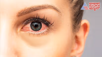  చలికాలంలో కళ్లు ఎర్రగా ఎందుకు అవుతాయి? 