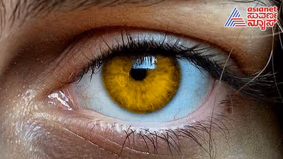 ಕಣ್ಣಿನ ಬಣ್ಣದಿಂದ ತಿಳಿಯುತ್ತೆ ಮನುಷ್ಯನ ರಹಸ್ಯ; ಅದು ಹೇಳುತ್ತೆ ಮನದ ಮಾತು..!