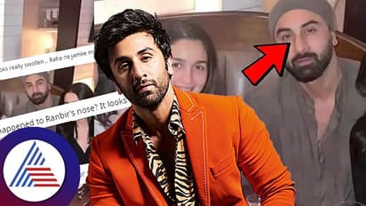 Ranbir Kapoor : ಬಾಲಿವುಡ್ ಸ್ಟಾರ್ ಗೆ ಬಾಲ್ಯದಿಂದ್ಲೇ ಇದೆ ಈ ಸಮಸ್ಯೆ 