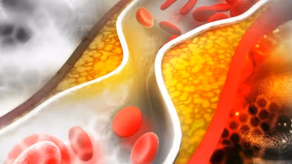 30 की उम्र में कितना कोलेस्ट्रॉल है सेहतमंद और कितना है खतरे की घंटी?