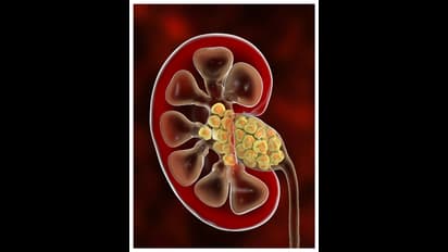 ಸುಮಾರು ವರ್ಷ ಬದುಕ್ಬೇಕಾ? ನರದ ಆರೋಗ್ಯದೆಡೆ ಇರಲಿ ಗಮನ