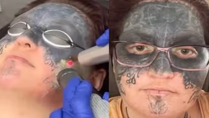 21 -ാം പിറന്നാളിന് കാമുകന്റെ 'സമ്മാനം', മയക്കുമരുന്ന് നൽകി മുഖമാകെ ടാറ്റൂ, ജോലി പോലും കിട്ടുന്നില്ല, ഒടുവിൽ