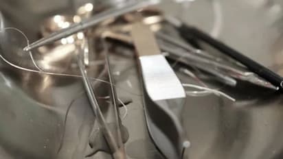 പ്രസവ ശസ്ത്രക്രിയയ്ക്കിടെ യുവതിയുടെ വയറ്റിനുള്ളില്‍ സര്‍ജിക്കല്‍ ഉപകരണം കുടുങ്ങി...