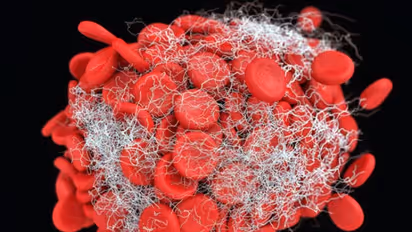 ലുക്കീമിയ; ഈ ലക്ഷണങ്ങൾ നിസാരമായി കാണരുത്...